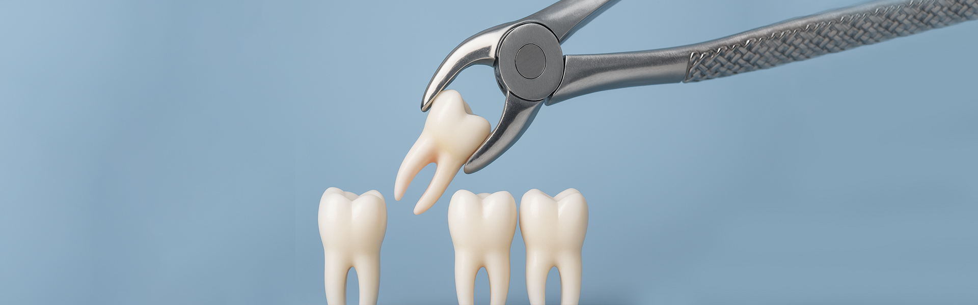 Exploring the Causes and Risks of Impacted Wisdom Teeth